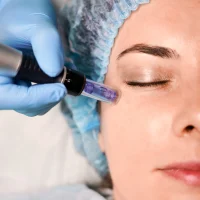 Sesión de activación de colágeno (incluye limpieza facial)